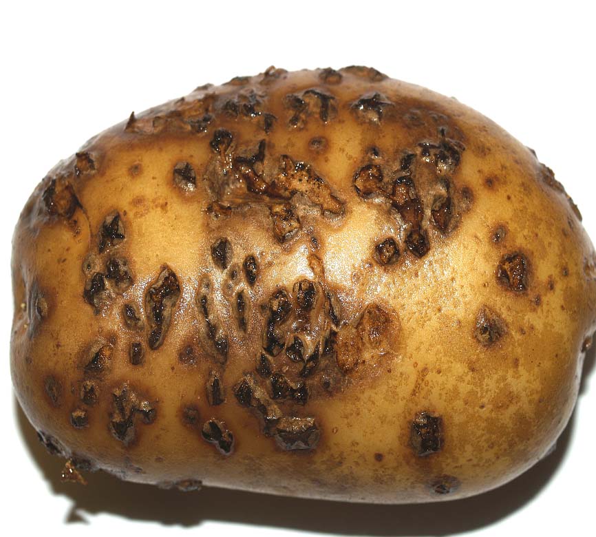 Причины болезни печени картофи